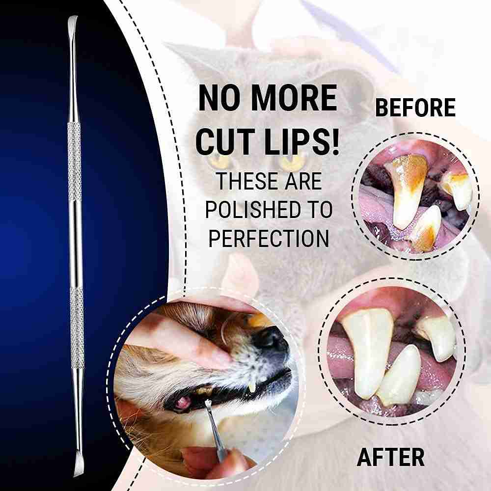 Professional Dental Hygiene Tool - Remove Stains, Plaque & Tartar